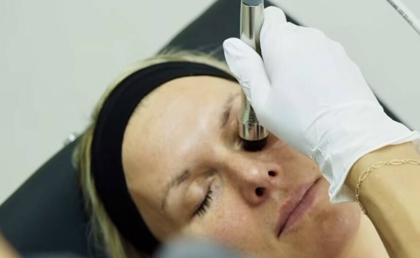 New technology for treating dry eye is being made available in Australia. Picture supplied