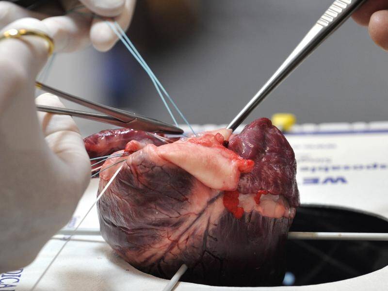 real human heart surgery