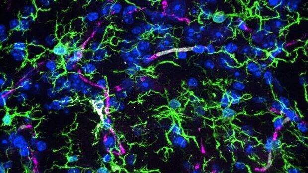 A snapshot of microglia (green cells) in an ageing mouse brain. Picture supplied